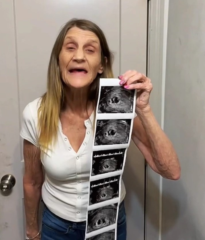 Annonce bébé du couple